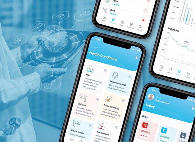 Featured image of Revero 